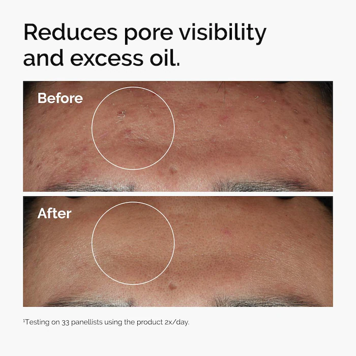 Niacinamide 10% + Zinc 1% image 3