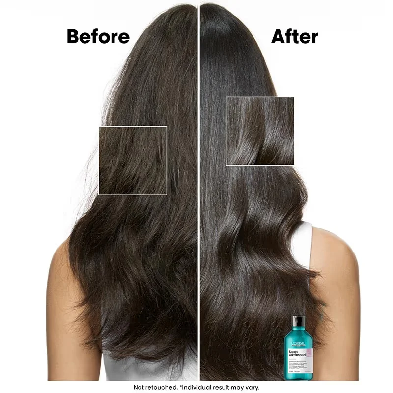 Scalp Advanced Anti-Discomfort Dermo-Regulator Shampoo image 2