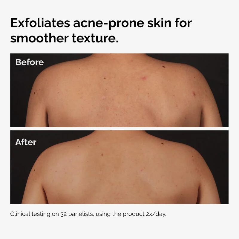 Body Serum Salicylic Acid image 3