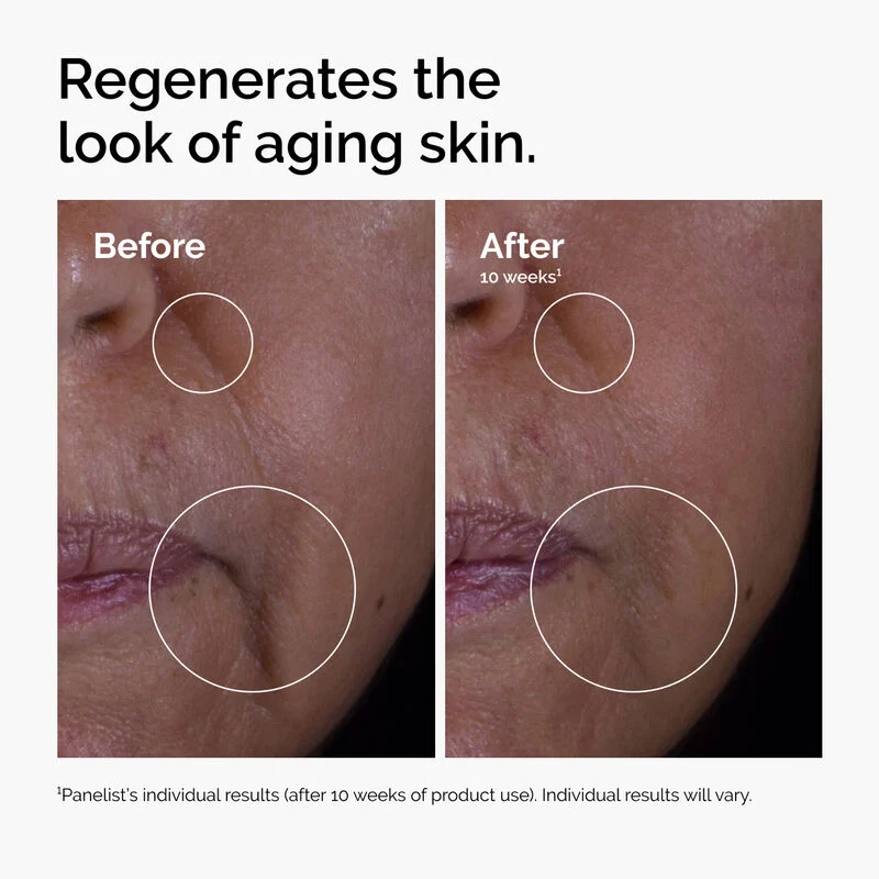 Serum GF 15% Solution image 4